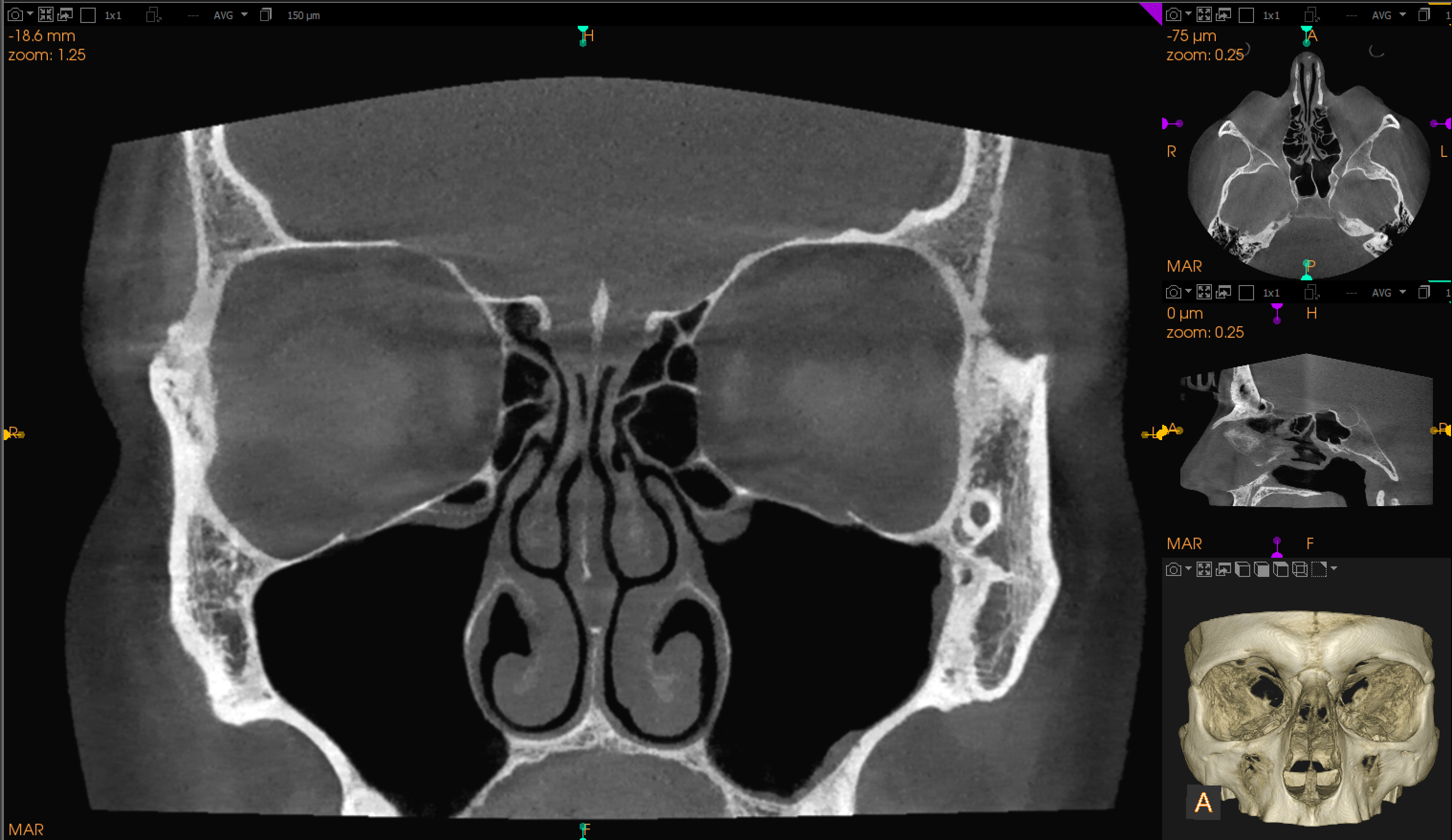 Pantomogram Kraków
