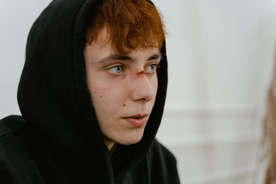 Jakie mogą być urazy szczęki